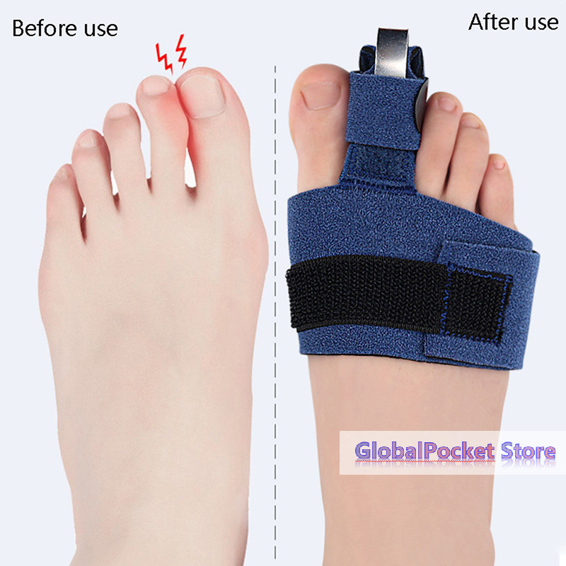 1Pcs Toe Corrector Toe Fractur - Ankle Brace Sock review and price